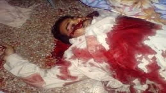 الزواج يدفع شابا لقطع رأس أبيه بالفأس