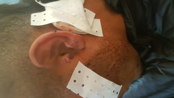 العيون:خطير مجرمون يحملون السلاح الأبيض يشرملو تلميذ خارج اسوار الثانوية التاهيلية ابن زهر