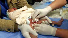 فاجعة … عملية ختان” بالشاون تنتهي باصابة أزيد من 20 طفلا بعاهات مستديمة